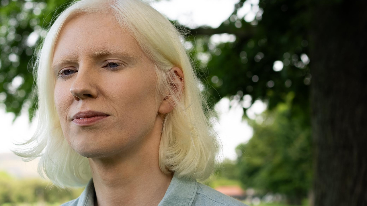 A white woman with albinism in her 20s with short white hair wearing a blue shirt stands in front of a blurred park background.